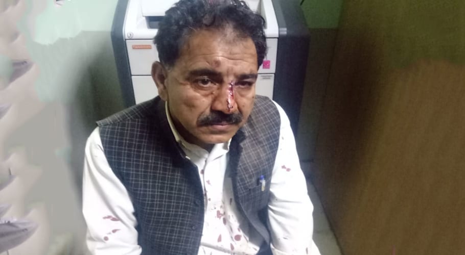 5 people including a lawyer were injured in firing in Islamabad
