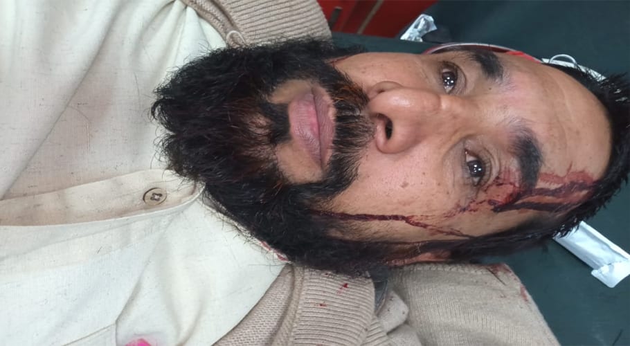 JUIF leader Abdul Zaheer Kakar injured in aurat march