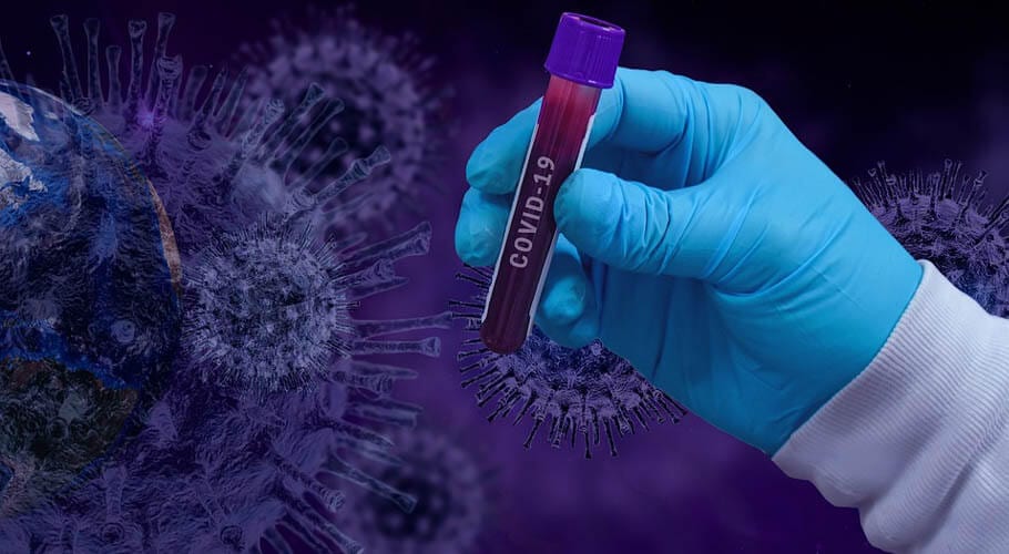 Coronavirus kills 27 Pakistanis, infects 903 in one day