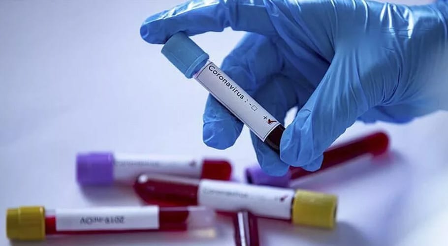 Global coronavirus death toll crosses 1,142,744