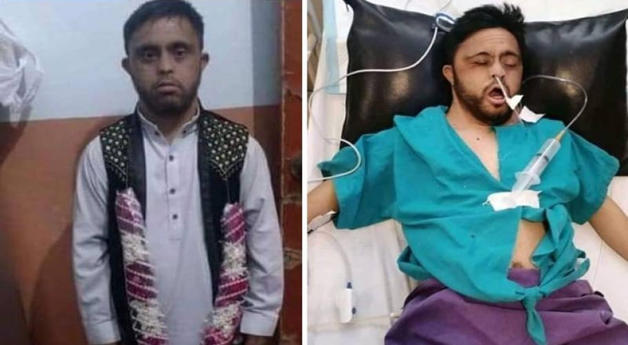 کراچی، جناح ہسپتال میں زیرِ علاج مریض عبید کا گردہ نکالنے کی خبر جھوٹی نکلی