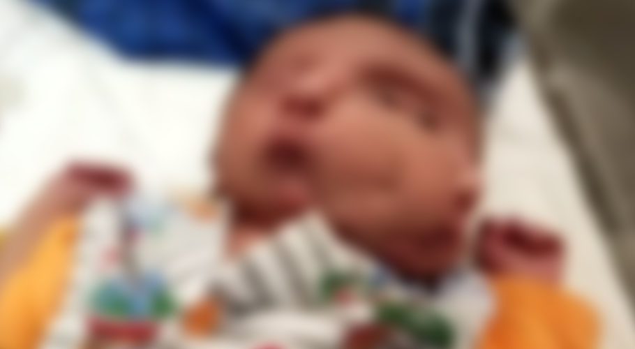 جہلم میں دو چہروں والے بچے کی پیدائش، ڈاکٹرز نے صحت تسلی بخش قرار دے دی
