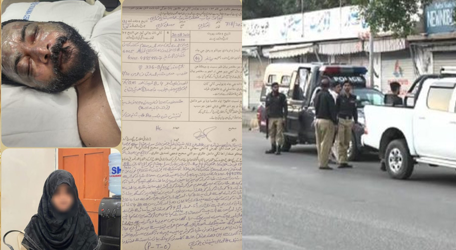 سابقہ شوہر پر تیزاب پھینکے والی ملزمہ لیاقت آباد سے گرفتار، مزید تفتیش جاری
