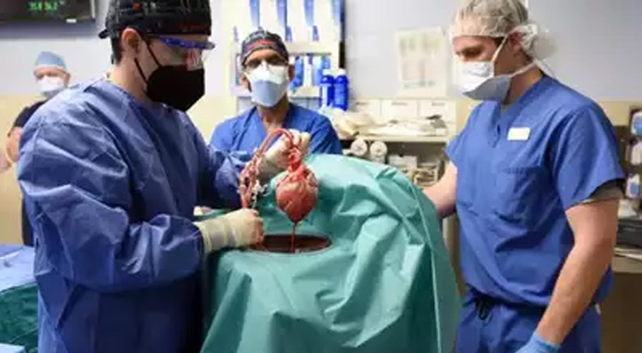 Pakistani doctor transplant full, live pig heart into human patient