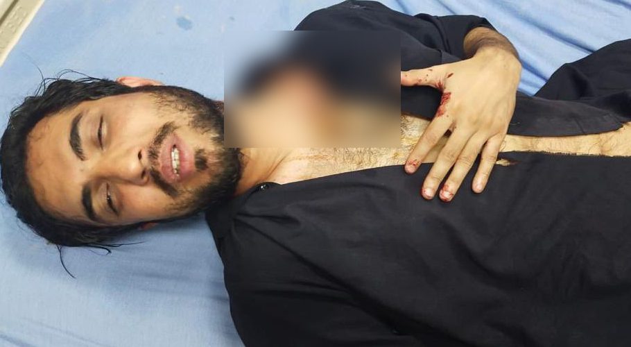 Iqrar ul Hassan tortured by government employees