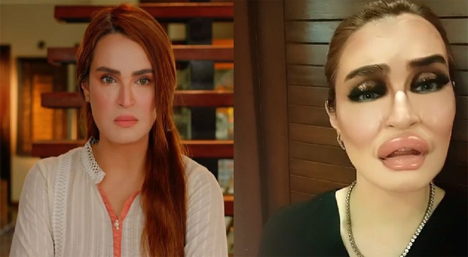 نادیہ حسین نے پلاسٹک سرجری کروانے والی خواتین پر تنقید کردی