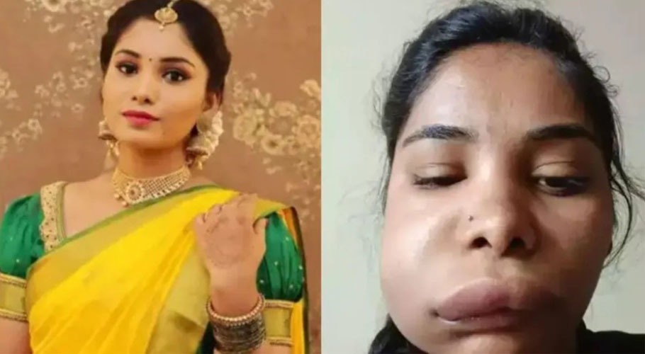 ڈاکٹروں کی غفلت، بھارتی اداکارہ کا چہرہ بگڑ گیا