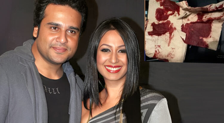 Bollywood actress Kashmera Shah injured in a terrifying glass accident!