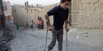 73 polio cases reported in Pakistan in 2024