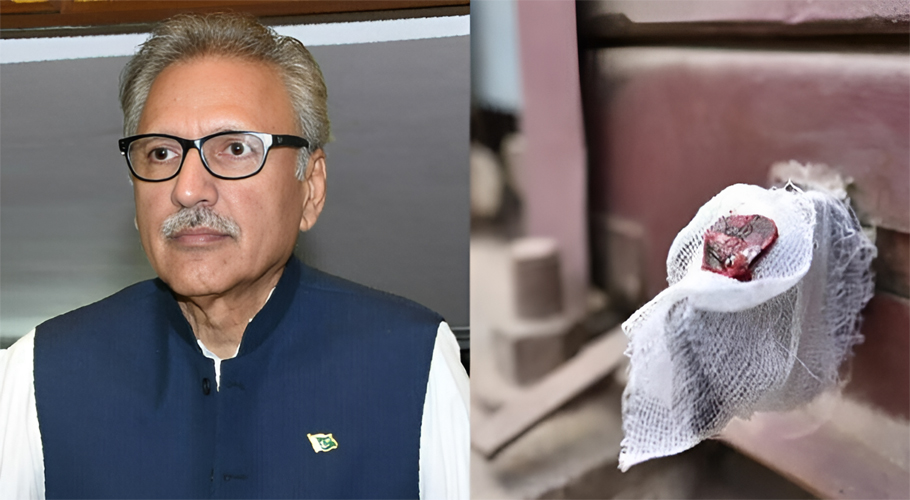 SBCA de-seals Arif Alvi’s dental clinic on court orders