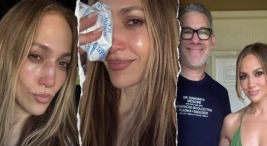 Jennifer Lopez suffers facial injury during rehearsals