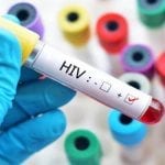 HIV