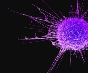Cancer-boosting cells multiply with age, says study