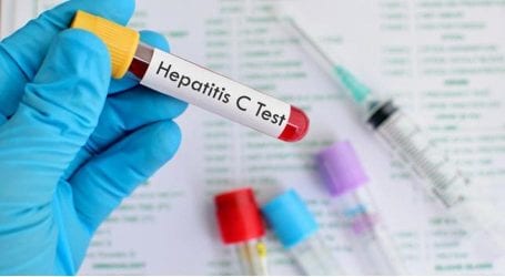 Hepatitis C symptoms detected in 120 students at IUB