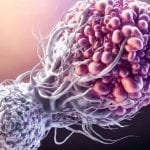 World Cancer Day: Free treatment of cancer in Pakistan