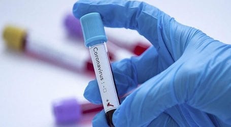 Coronavirus cases jump to 21,500 in Pakistan