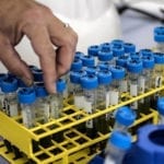 Pakistan’s first COVID-19 patient recovers from plasma therapy