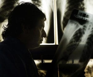 COVID-19 lockdown risks 1.4 million extra TB deaths: study