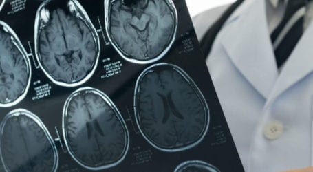 COVID-19 may cause problems linked with brain