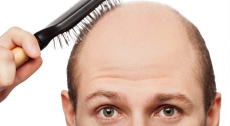 Good news for baldheads: Drug invented to fully grow back lost head’s hair