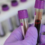 The NHS is launching the world's biggest trial of a potentially life-saving blood test. Source: Pixabay