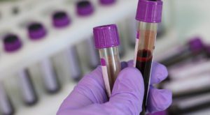 The NHS is launching the world's biggest trial of a potentially life-saving blood test. Source: Pixabay