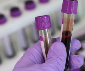 Britain begins world’s largest blood test trial for 50 types of cancer