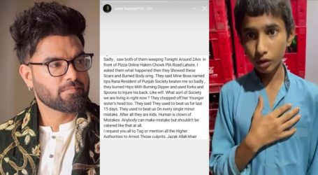 Burnt with dipper, forks and spoons: Yasir Hussain shares horrific child abuse story