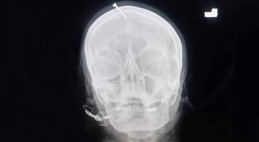 Pregnant victim expressed need for a son owing to her husband's desire