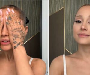 Ariana Grande admits she had a ‘ton of lip filler and botox’